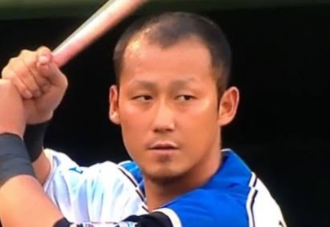 ハゲ疑惑中田翔
