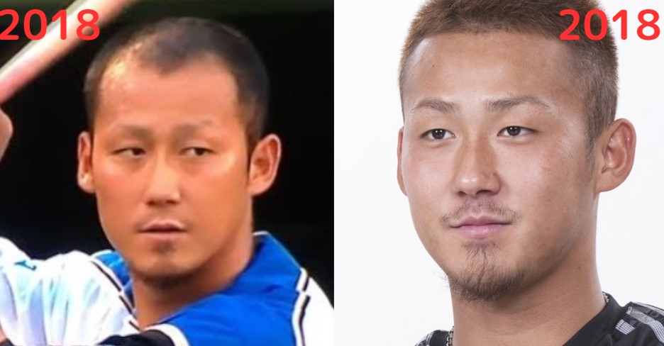 生え際比較