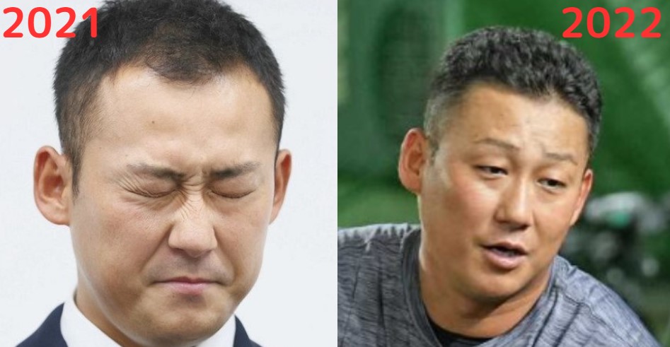生え際比較