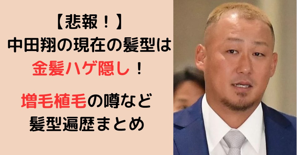 中田翔金髪ハゲ隠し髪型遍歴